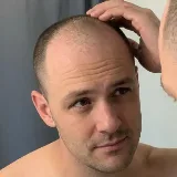 Sam Keller